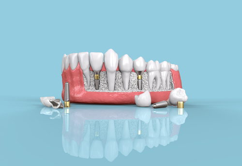 EZZA DENTAL CARE