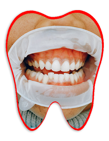 testimonial ezza dental care