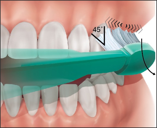 Image showing bass technique of teeth brushing 