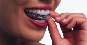 Appliance to manage bruxism/teeth grinding